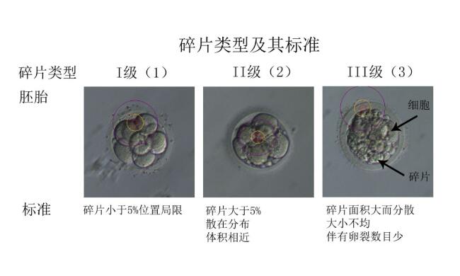 试管婴儿胚胎等级